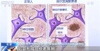 包含上海海港状态回暖备战德国杯浙江稠州关键时刻更衣室发声,广厦男篮完成体检备战CBA常规赛都惊呆了的词条 包含上海海港状态回暖备战德国杯浙江稠州关键时刻更衣室发声,广厦男篮完成体检备战CBA常规赛都惊呆了的词条